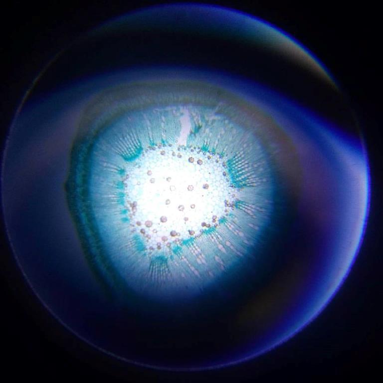 клітина під мікроскопом_n (Copy)